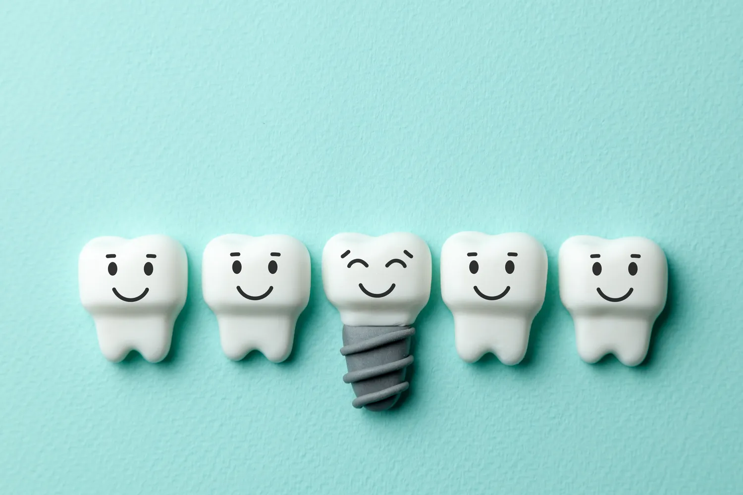 Ile trwa odbudowa kości pod implanty?