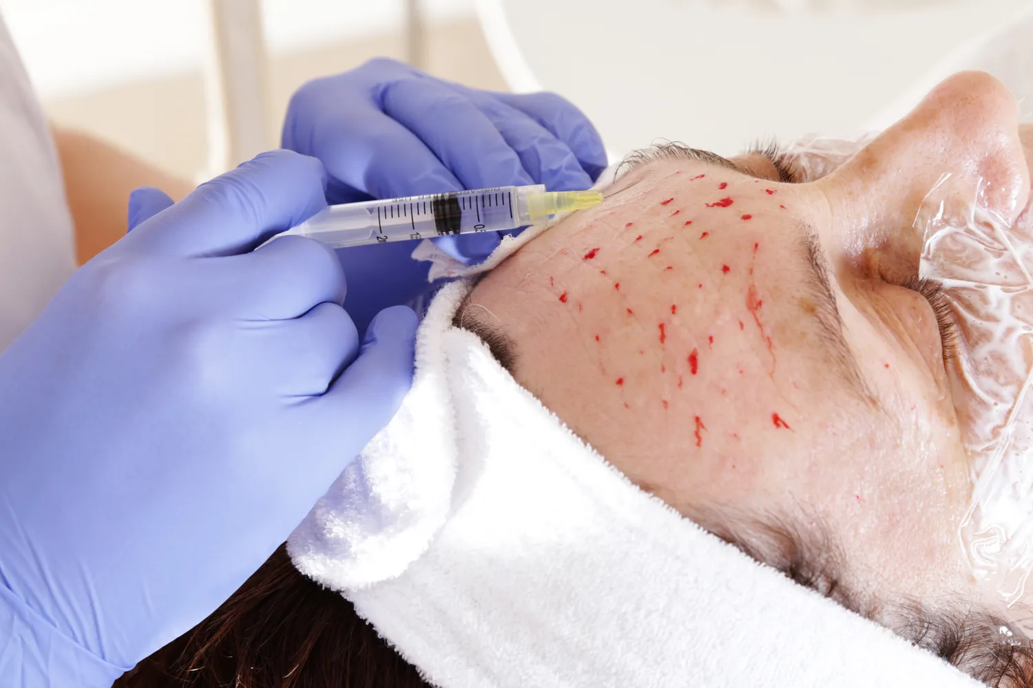 Ile zarabia medycyna estetyczna?