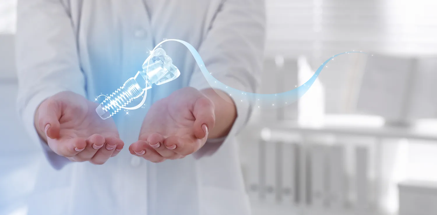 Implanty zębowe - co i jak?