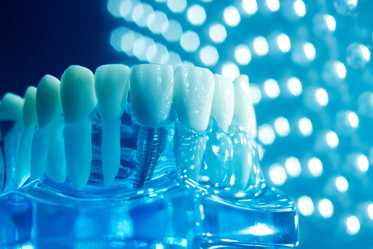 Dzieci u dentysty