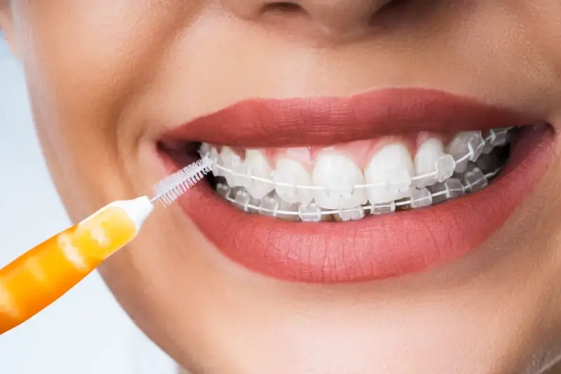 Leczenie kanałowe pod mikroskopem Szczecin