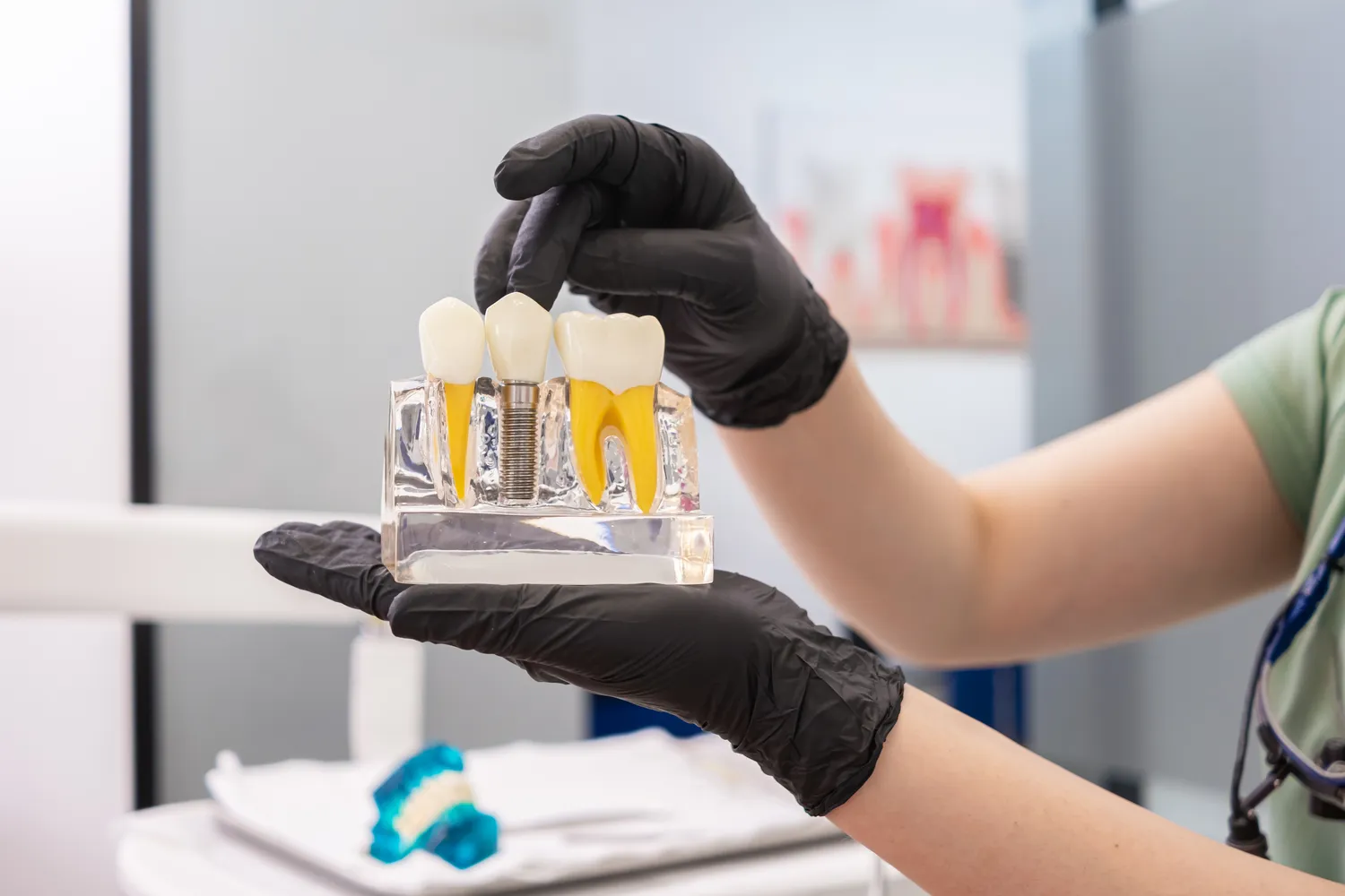 Implanty w jeden dzień Stargard